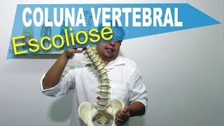 Coluna Vertebral  Escoliose [upl. by Sulamith]