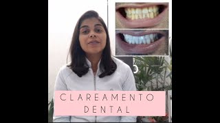 CLAREAMENTO DENTAL Como é feito Quanto tempo dura Causa sensibilidade [upl. by Vittorio]