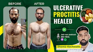 Anand gets rid of Ulcerative Proctitis  Med free [upl. by Brnaba78]