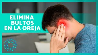 ¿POR QUÉ tengo un BULTO en la OREJA 👂🏻 Causas y tratamiento [upl. by Llenra]