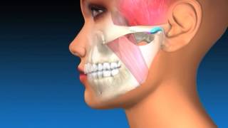 TMJ Explanation amp Therapy [upl. by Wendalyn238]