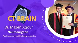 CT brain correlated with anatomy by Dr Mazen Agour [upl. by Zirkle]