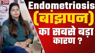 Endometriosis Symptoms Causes and Natural Treatment  Dr Chanchal Sharma [upl. by Adnauqal]