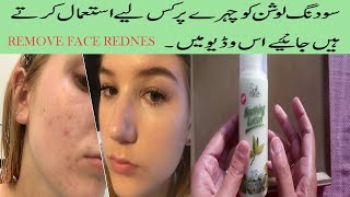 How To Use Soothing Lotion On Face Soothing Lotion UsagebenefitsSoft Touch Shooting Lotion Review [upl. by Nnylf337]