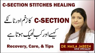 C Section Delivery Internal Stitches Wound Healing  Care Recovery amp Tips  Tanky Kesy Theek Kren Gy [upl. by Chilson]