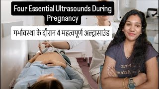 Four Important Scans During Pregnancy  Ultrasound Scans During Pregnancy pregnancyultrasound [upl. by Aryajay]