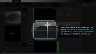 06 Biometry OCT Axial Lenght Manual Mode [upl. by Milman]