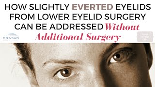 Ectropion and Lower Lid Retraction after Eyelid Surgery  Diagnosing Severity and Need for Revision [upl. by Jerusalem453]