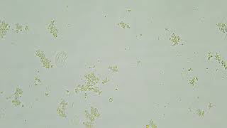 Activia yogurt under a microscope [upl. by Ahsinek]