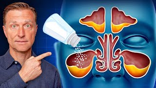 Rid Throat and Sinus Mucus with SALT [upl. by Norb]