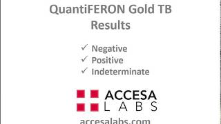 TB Blood Test QuantiFERON Gold TB Blood Test Results Overview [upl. by Caraviello]