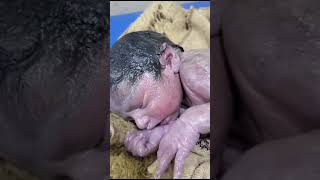 Vernix caseosaknown as vernix is the waxy white substance found coating the skin newborn human baby [upl. by Almira]