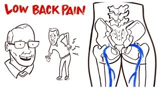 Low Back Pain [upl. by Eedolem186]