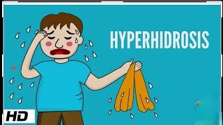 Hyperhidrosis Causes Signs andSymptoms Diagnosis and Treatmnt in Homoepathy by Dr sarfaraz Ansari [upl. by Ddet]