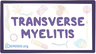 Transverse myelitis  an Osmosis Preview [upl. by Dugan]