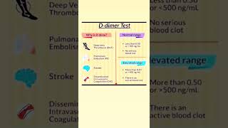 Ddimer Test youtubeshorts neet medicalnursing norcetstudytips [upl. by Chester]