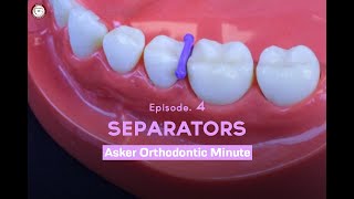 Separators Asker Orthodontic Minute Episode 4 [upl. by Chuch484]