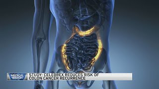 Study Celebrex reduces risk of colon cancer recurrence — and more [upl. by Dahij548]