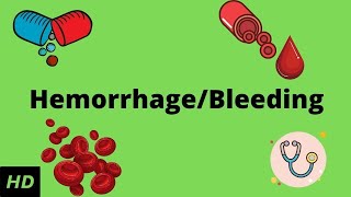 Hemorrhage bleeding Causes Signs and Symptoms Diagnosis and Treatment [upl. by Stover578]