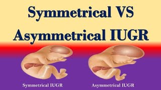 Symmetrical and Asymmetrical IUGR Differences  Symmetrical Vs Asymmetrical IUGR [upl. by Oibaf167]