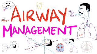 Airway Management  Tracheal Intubation  Anesthesiology Series [upl. by Sset]