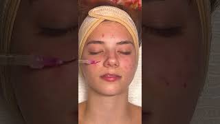 ASMR Relaxing Facial on katemariess [upl. by Sulamith]