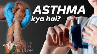 Asthma Kya Hai Aur Iska Ilaj Kaise Kiya Jata Hai  Ek Gehra Nazariya Sans Ki Bimari Par in Hindi [upl. by Izzy889]