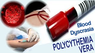 Polycythemia Vera  Blood Dyscrasia  Causes Symptoms Diagnosis and Treatment [upl. by Munshi]