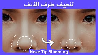 How to naturally slim the nose tip  Fix wide nose tip  Fix Bulbous nose tip [upl. by Eerat418]