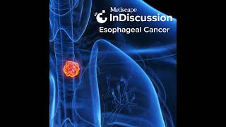 Emerging Biomarkers and Novel Therapies for Esophageal Cancer [upl. by Shurlocke]