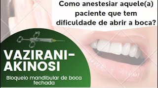 Bloqueio mandibular de boca fechada técnica de vaziraniakinosi [upl. by Virgina]