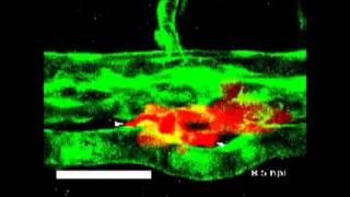 Efficient extravasation of tumorrepopulating cells depends on cell deformability [upl. by Alcot]