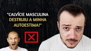 A CALVÍCIE MASCULINA ESTÁ ACABANDO MEU LADO EMOCIONAL [upl. by Nalym690]