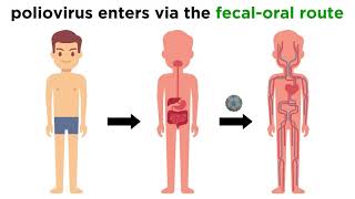 Poliomyelitis Poliovirus [upl. by Aicac]