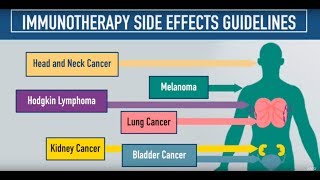 Immunotherapy Side Effects Guidelines [upl. by Hallie]