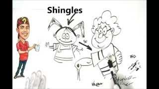 Shingles Explained Simply [upl. by Otirecul]