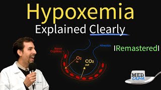 Hypoxemia  The 5 Causes amp Treatment 1 High Altitude [upl. by Yetsirhc]