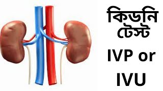 IVP or IVU kidney test কিডনি টেস্ট IVP or IVU [upl. by Atteiluj]