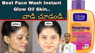 Clean Clear Best Face Wash  For Oily Skin and glowing skincare [upl. by Lebbie437]