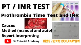 pt inr test Prothrombin time test [upl. by Zeta294]