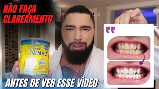 COMO FAZER CLAREAMENTO DENTAL CASEIRO COM LEITE EM PÓ E SMILINE [upl. by Kilah639]