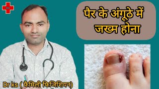 per ke anguhte me jakham ka ilaj l great toe infection l per ke anguhte me infecton kyo hota h l [upl. by Dib649]