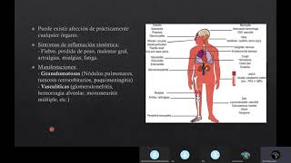 Granulomatosis con Poliangeitis [upl. by Stralka]