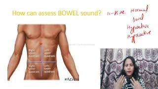 How to Assess BOWEL SOUNDProcedure of bowel Sound assessment AUSCULTATION OF ABDOMEN BORBORYGMUS [upl. by Xel102]