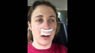 30 minutes after Septoplasty and bilateral Turbinate Reduction surgery [upl. by Sparkie]