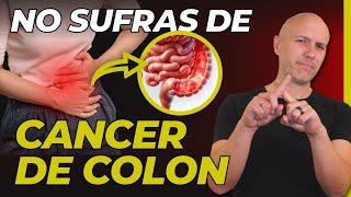 ¡Es MORTAL pero PREVENIBLE Alimentos para EVITAR EL CÁNCER DE COLON [upl. by Chester]