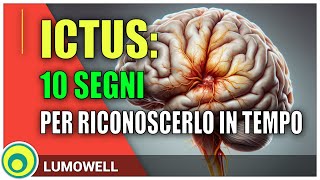 I Sintomi di un Ictus Cerebrale [upl. by Ravilob]