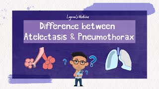 Atelectasis vs Pneumothorax atelectasis pneumothorax [upl. by Kimberli]