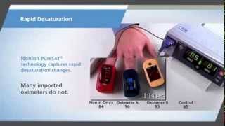 Nonin Onyx Vantage Finger Pulse Oximeter [upl. by Ida]