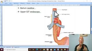 Esophageal disorders in Arabic 1  General principles   by Dr Wahdan [upl. by Tehr982]